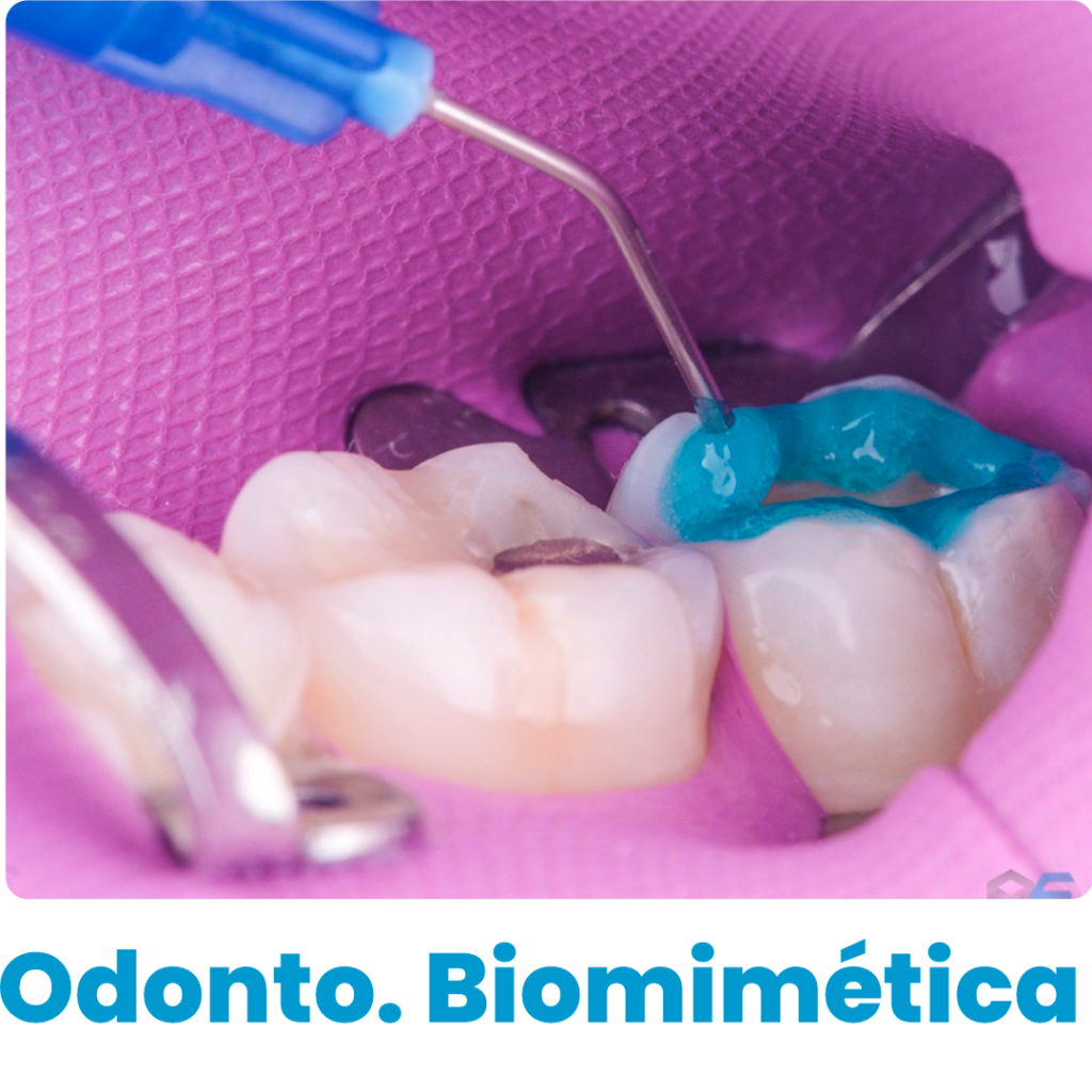 O conceito de biomimética na medicina dentária, é a devolução das propriedades funcionais, mecânicas, e estéticas da estrutura dentária, através da utilização de materiais que mimetizam as propriedades dos tecidos perdidos, e da sua integração com o remanescente dentário, cumprindo assim o princípio Biomimético.