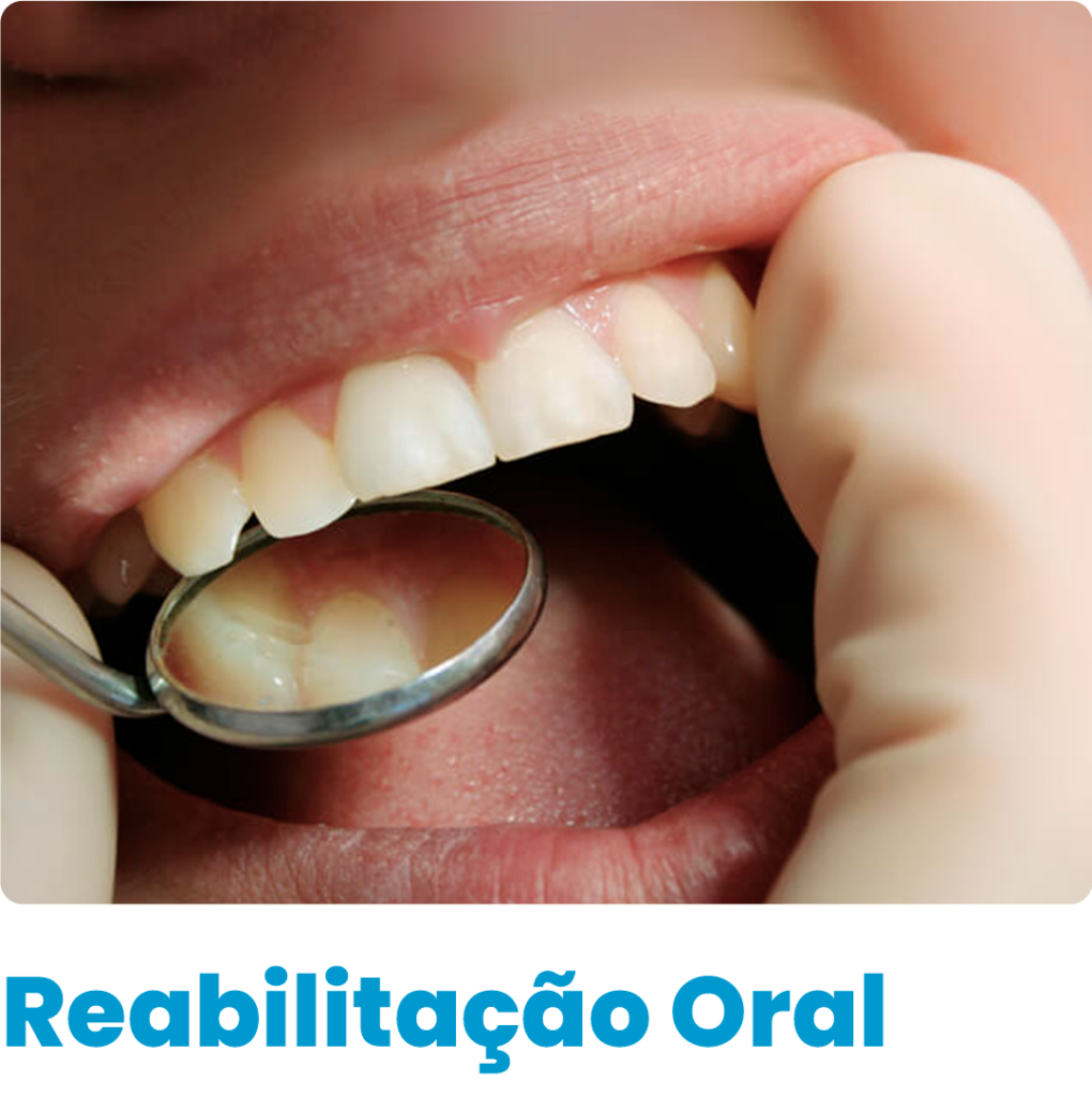 A reabilitação oral consiste em um conjunto de técnicas e tratamentos que têm por finalidade restabelecer a estética e o aspecto funcional do sorriso, garantindo dentes saudáveis e mais qualidade de vida para o paciente.